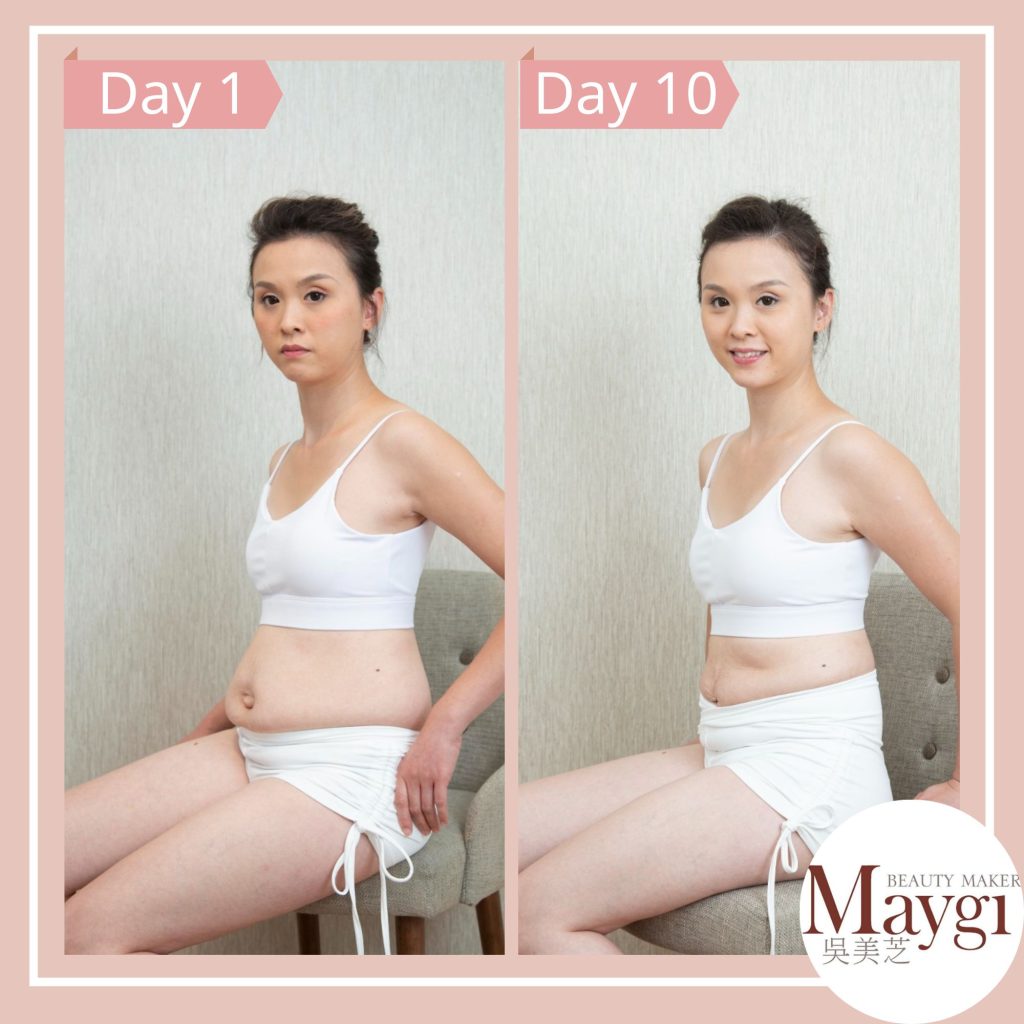 Before and after
