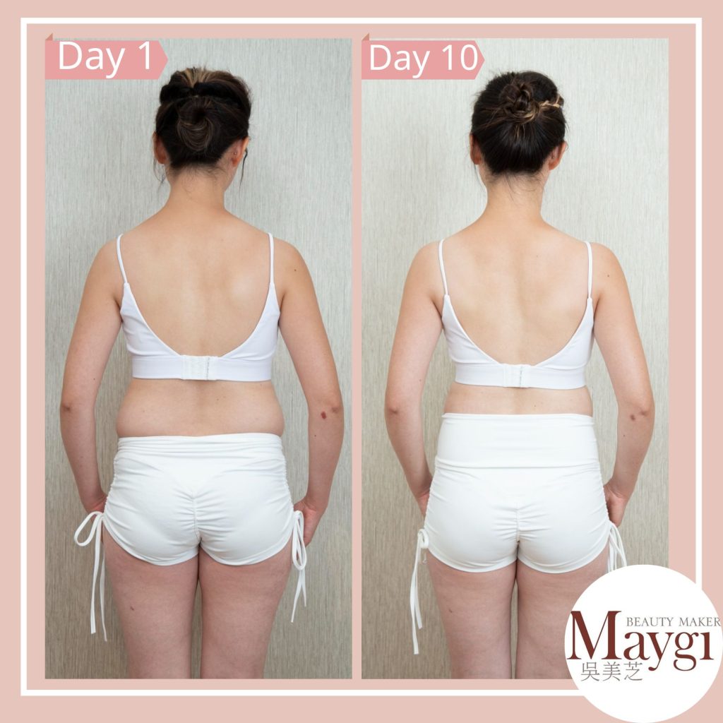 Before and after