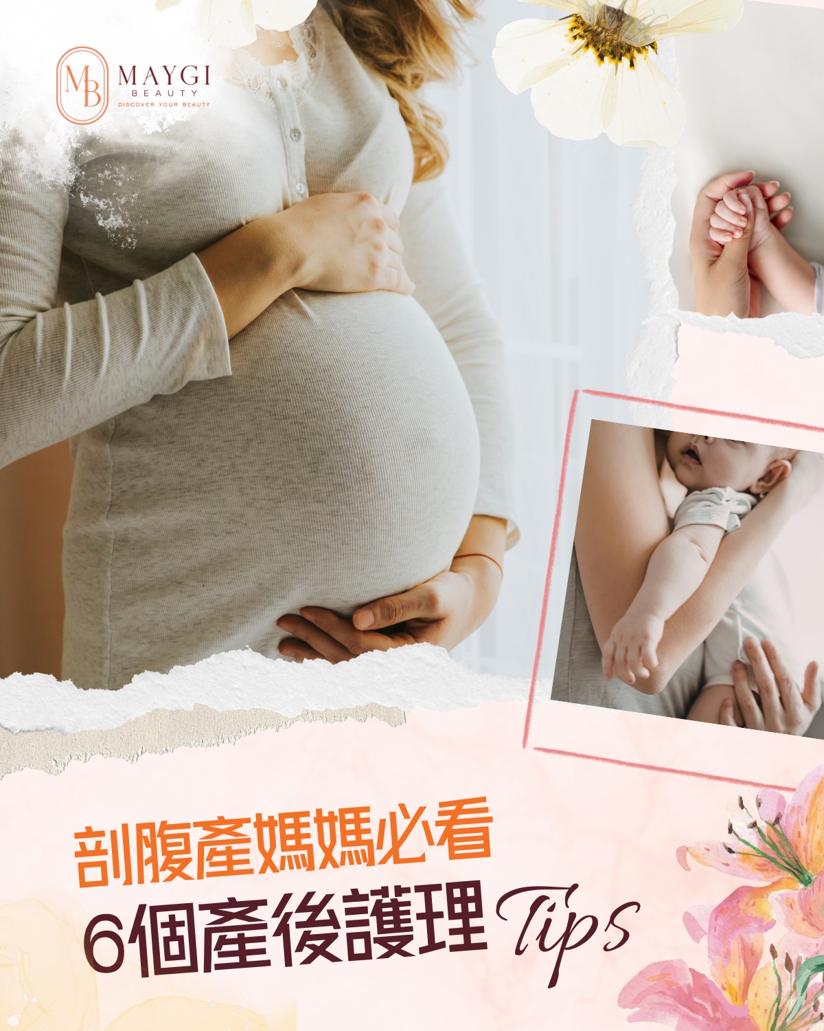 🌷Maygi Beauty 提提你 剖腹產後護理小貼士💡
