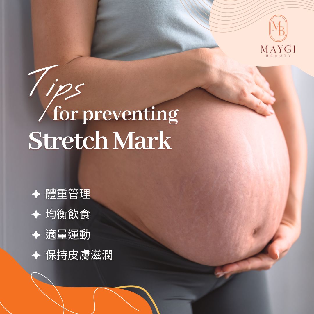 Maygi Beauty提提你 好好預防妊娠紋🙋
